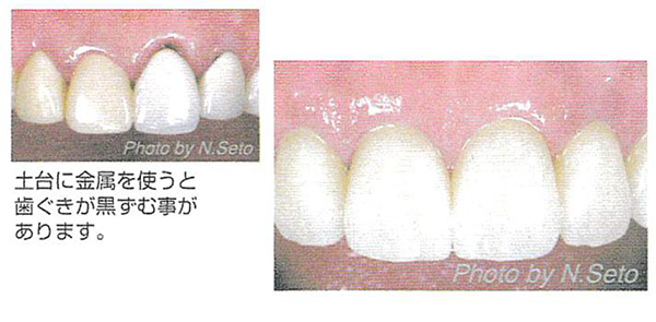 東京都目黒区にある松村歯科クリニック メタルフリー治療